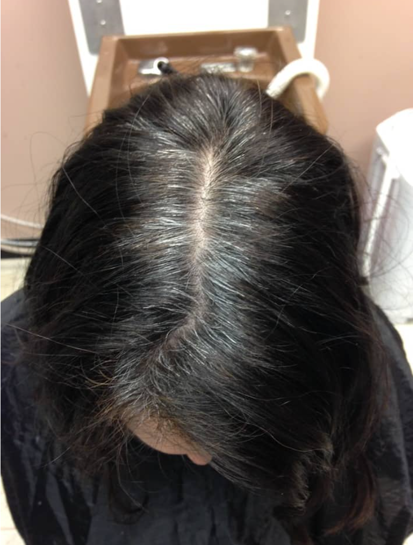 Before Image