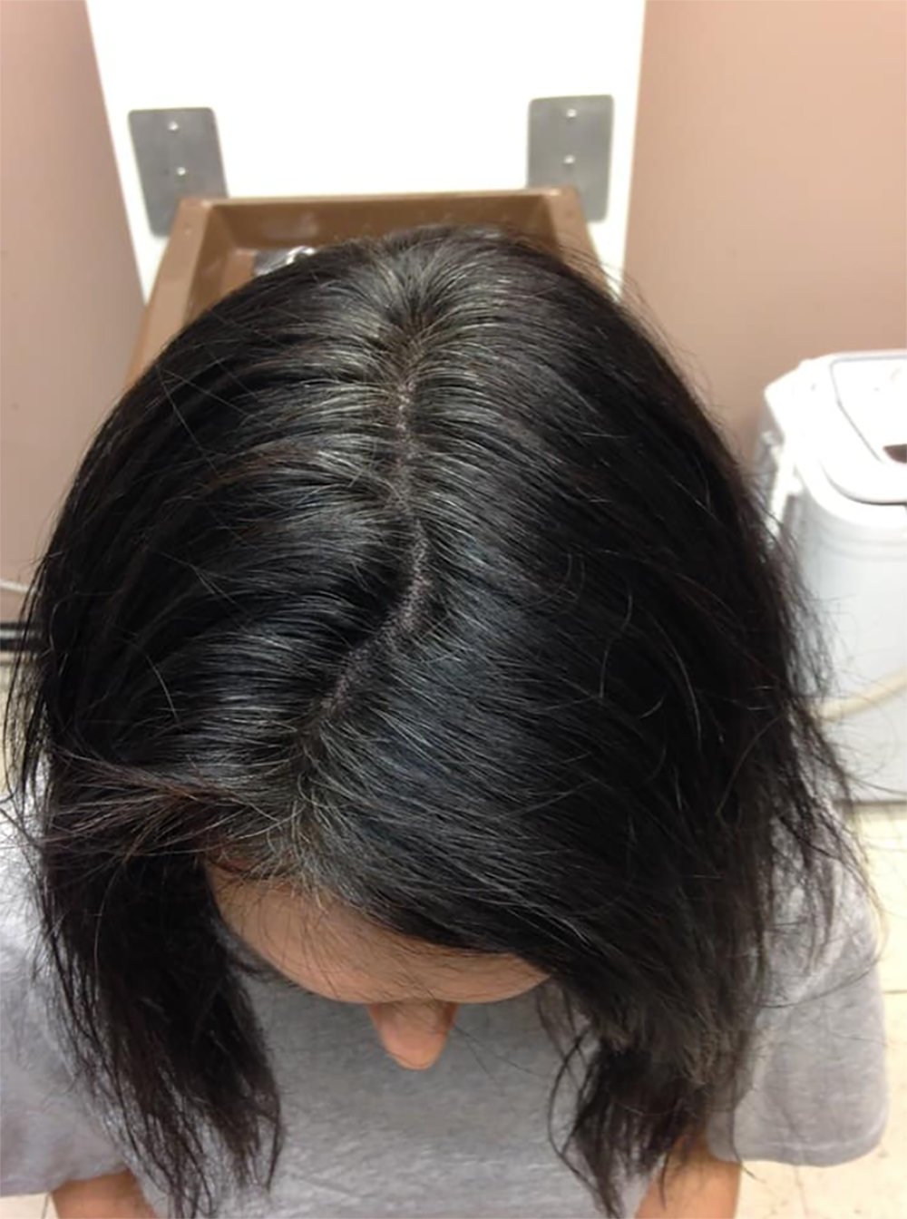 After Image